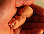 Abortion: A New Consensus?