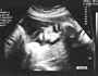 Life Before Birth